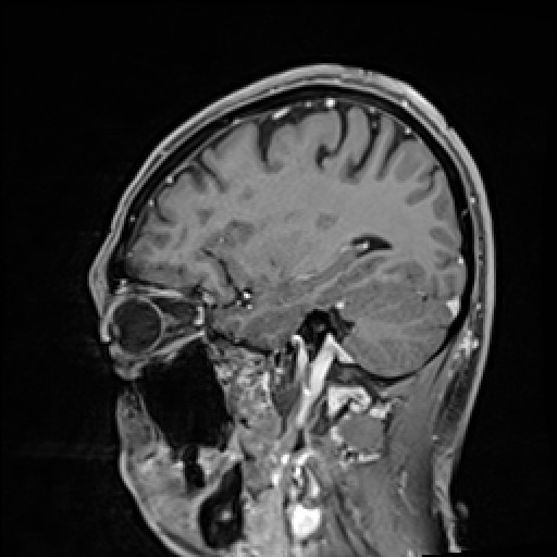 Click on the Serie image to view the images of VILLANUEVA, WILLIAM A.